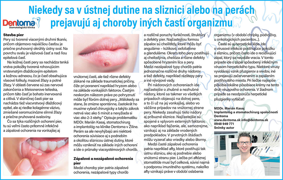 Marián Kasaj zubná chirurgia a implantológia, http://drkasaj.sk/ , http://drkasaj.sk/zubnaimplantologia.html , Martin, martin, drkasaj.sk, Mari